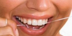 علاج اصفرار الاسنان وتراكم الجير