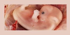 سبب توقف نمو الجنين