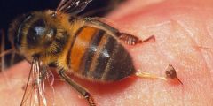 علاج لسعة النحلة