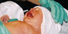 اسباب بكاء الطفل عند الولادة