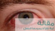 كيفية علاج حساسية العين واحمرارها
