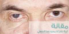 انواع مرض المياه الزرقاء في العين