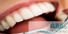 طرق منزلية لعلاج تسوس الأسنان