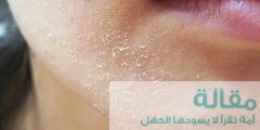 علاج جفاف الوجه بالطرق الطبيعية