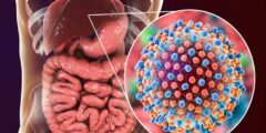 أسباب وأعراض التهاب الكبد الوبائي
